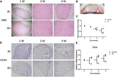 Radiation-induced FAP + fibroblasts are involved in keloid recurrence after radiotherapy